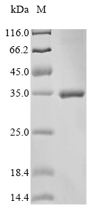 Recombinant Gloydius ussuriensis Thrombin-like enzyme calobin-1