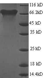 Recombinant Helicobacter pylori Urease subunit beta(ureB)