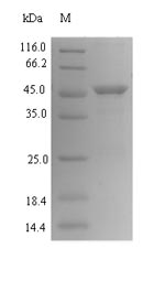 Recombinant Helicobacter pylori Vacuolating cytotoxin autotransporter(vacA),partial