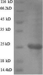 Recombinant Helicobacter pylori Vacuolating cytotoxin autotransporter(vacA),partial