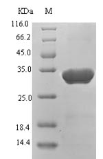 Recombinant Hepatitis B virus genotype D subtype ayw Protein X(X)