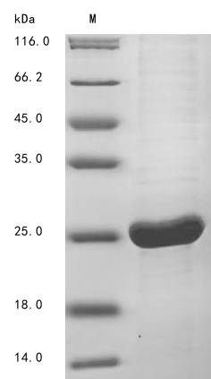 Recombinant Hepatitis B virus genotype D subtype ayw Protein X(X)