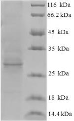 Recombinant Hepatitis E virus genotype 1 Protein ORF3 (ORF3)