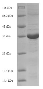 Recombinant Horse Erythropoietin(EPO)