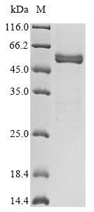 Recombinant Horse Prolactin(PRL)