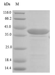 Recombinant Human  Laminin subunit beta-1(LAMB1),partial