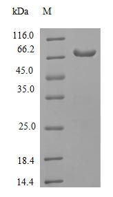 Recombinant Human  Receptor-interacting serine/threonine-protein kinase 3(RIPK3)