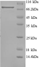 Recombinant Human  Tumor protein 63(TP63)