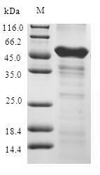 Recombinant Human 1-acylglycerol-3-phosphate O-acyltransferase ABHD5(ABHD5)