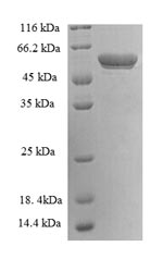Recombinant Human 14-3-3 protein eta(YWHAH),partial
