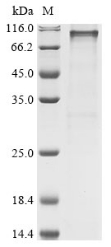 Recombinant Human 2-5A-dependent ribonuclease(RNASEL)