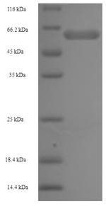 Recombinant Human 2-oxoglutarate dehydrogenase, mitochondrial(OGDH)