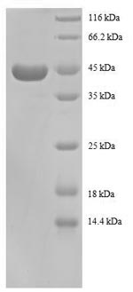 Recombinant Human 40S ribosomal protein S13(RPS13),partial