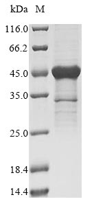 Recombinant Human 40S ribosomal protein S3(RPS3)