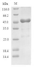Recombinant Human 60S acidic ribosomal protein P0(RPLP0)