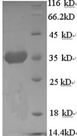 Recombinant Human 78KDA glucose-regulated protein(HSPA5),partial