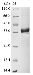 Recombinant Human A disintegrin and metalloproteinase with thrombospondin motifs 4(ADAMTS4),partial