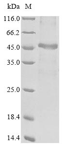 Recombinant Human ADP-ribose glycohydrolase MACROD1(MACROD1)