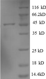 Recombinant Human ADP-ribosylation factor-like protein 2-binding protein(ARL2BP)