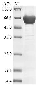 Recombinant Human AP-1 complex subunit beta-1(AP1B1),partial