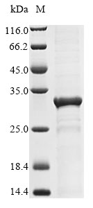 Recombinant Human AT-rich interactive domain-containing protein 4B(ARID4B),partial