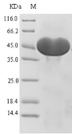 Recombinant Human ATP-citRate synthase(ACLY),partial