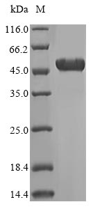 Recombinant Human ATP synthase subunit beta, mitochondrial(ATP5F1B),partial