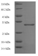 Recombinant Human ATP synthase subunit delta, mitochondrial(ATP5D)