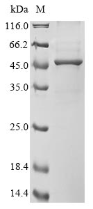 Recombinant Human Acetyl-CoA acetyltransferase, cytosolic(ACAT2)
