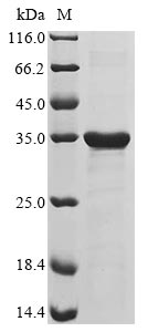 Recombinant Human Achaete-scute homolog 1(ASCL1)