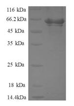 Recombinant Human Activator of 90 kDa heat shock protein ATPase homolog 1(AHSA1)