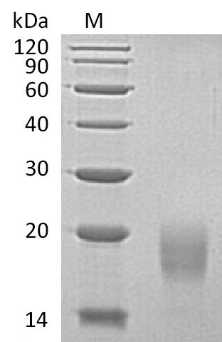Recombinant Human Activin receptor type-1B(ACVR1B),partial (Active)