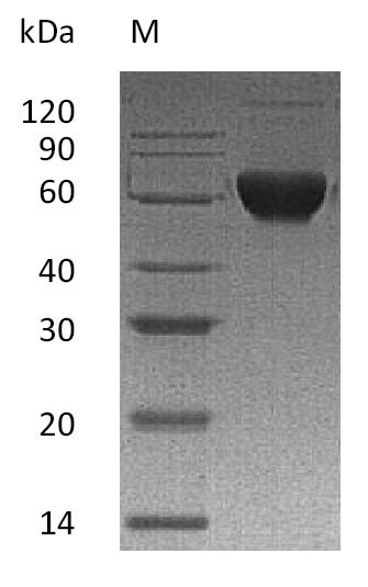 Recombinant Human Activin receptor type-2B(ACVR2B),partial (Active)