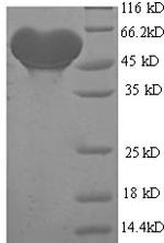 Recombinant Human Alcohol dehydrogenase 1B(ADH1B)