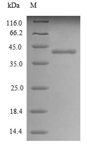 Recombinant Human Alkaline phosphatase, placental type(ALPP),partial