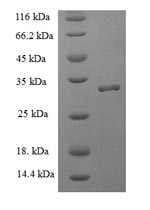 Recombinant Human Allograft inflammatory factor 1(AIF1)