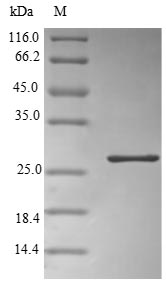 Recombinant Human Alpha-1-acid glycoprotein 2(ORM2)