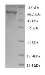 Recombinant Human Alpha-L-iduronidase(IDUA)