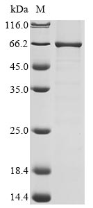 Recombinant Human Alpha-ketoglutarate-dependent dioxygenase FTO(FTO)