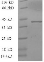 Recombinant Human Alpha-synuclein(SNCA),partial
