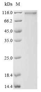 Recombinant Human Amyloid-beta A4 precursor protein-binding family A member 2(APBA2)
