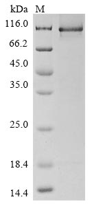Recombinant Human Amyloid beta A4 precursor protein-binding family A member 2(APBA2)