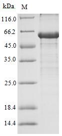 Recombinant Human Androgen receptor(AR),partial