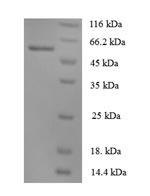Recombinant Human Angiopoietin-1(ANGPT1)