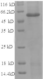Recombinant Human Angiopoietin-2(ANGPT2),partial