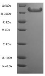 Recombinant Human Angiopoietin-related protein 2(ANGPTL2)