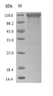 Recombinant Human Angiotensin-converting enzyme 2(ACE2),partial (Active)