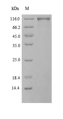 Recombinant Human Angiotensin-converting enzyme 2(ACE2),partial,Biotinylated (Active)