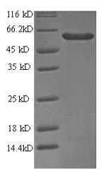 Recombinant Human Antiviral innate immune response receptor RIG-I(DDX58),partial