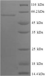 Recombinant Human Apolipoprotein A-IV(APOA4)